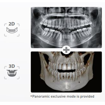Panoramic x ray 2D/3D photo