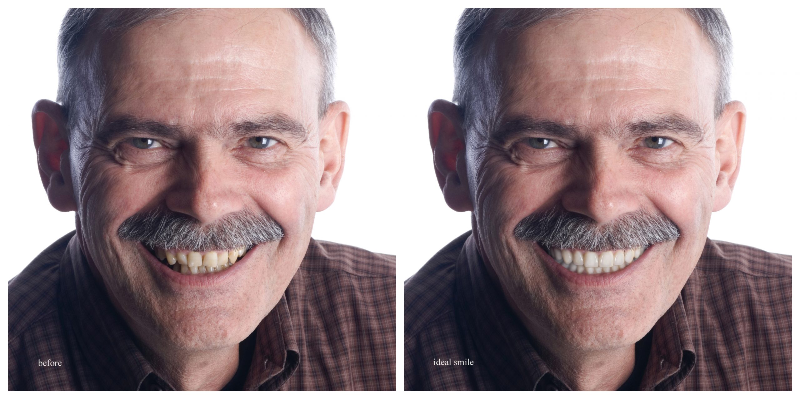 Smile Restoration - Before and After14