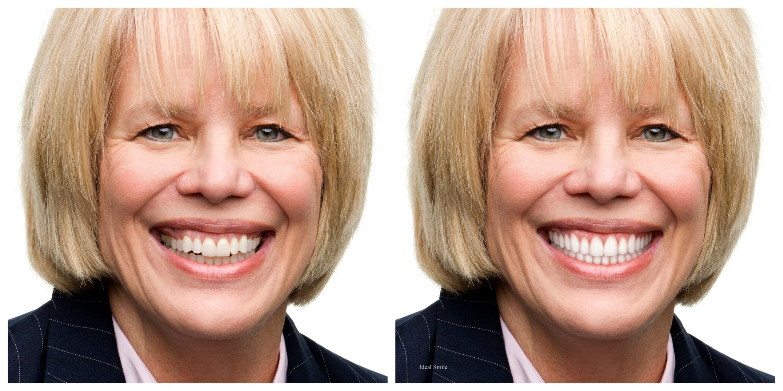 Smile Restoration - Before and After29