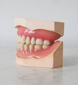 Aesthetic tooth lengthening photo
