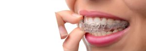 Bite guard photo