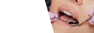 Dental crowns photo