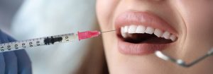 Gum rejuvenation photo