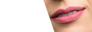 Juvaderm fillers photo