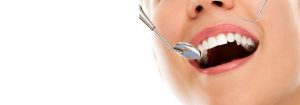 Periodontal prophylaxis photo