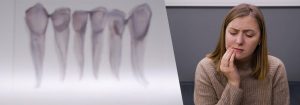 Tmj therapy woman patient photo