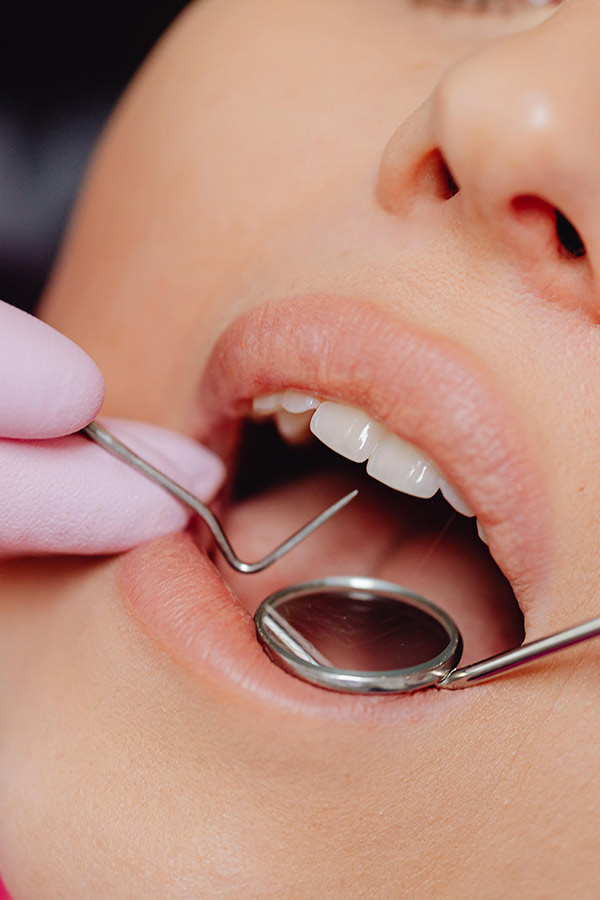 Improve Your Smile - Periodontal Prophylaxis, photo 1