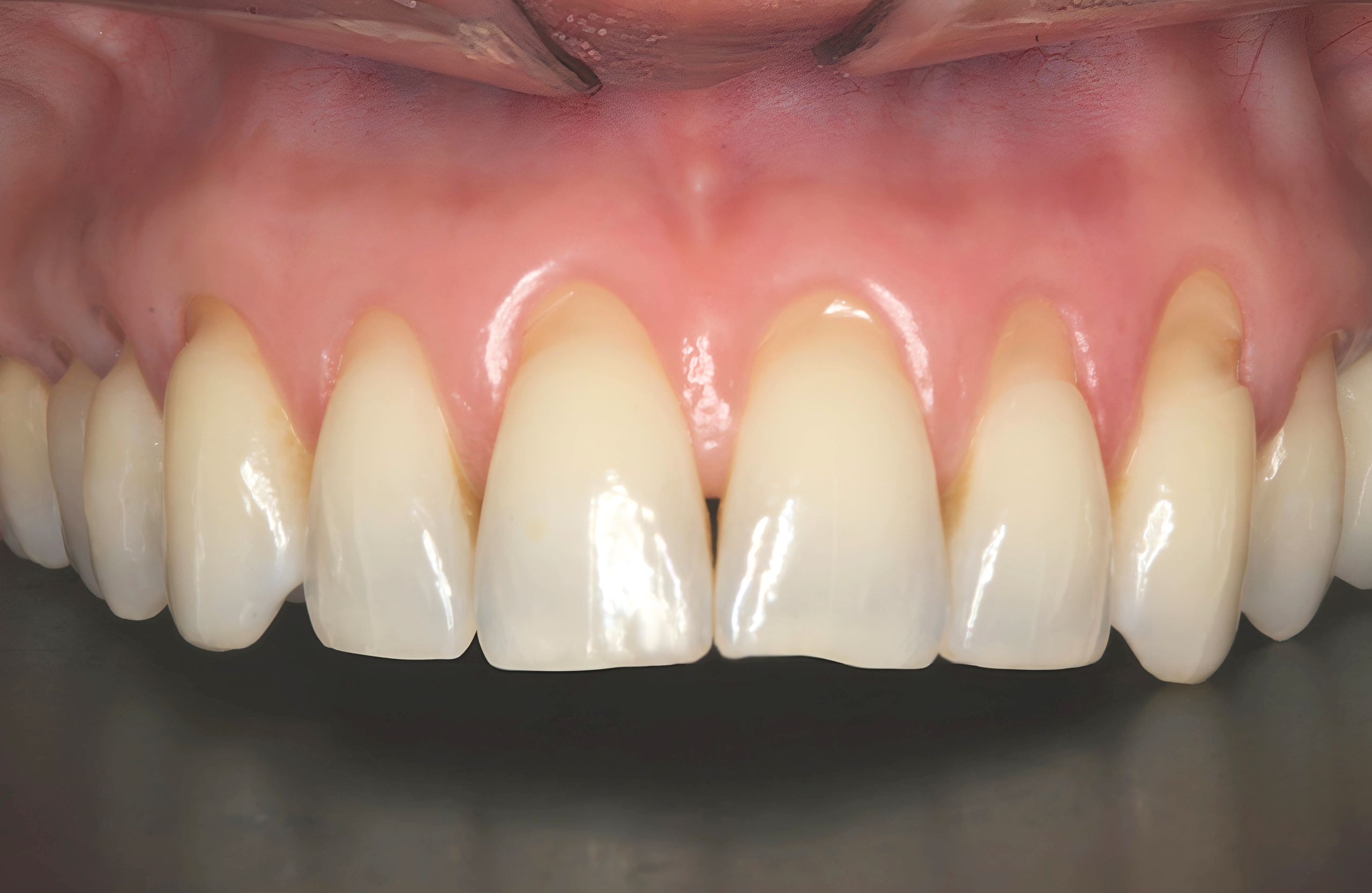 Before patient 8