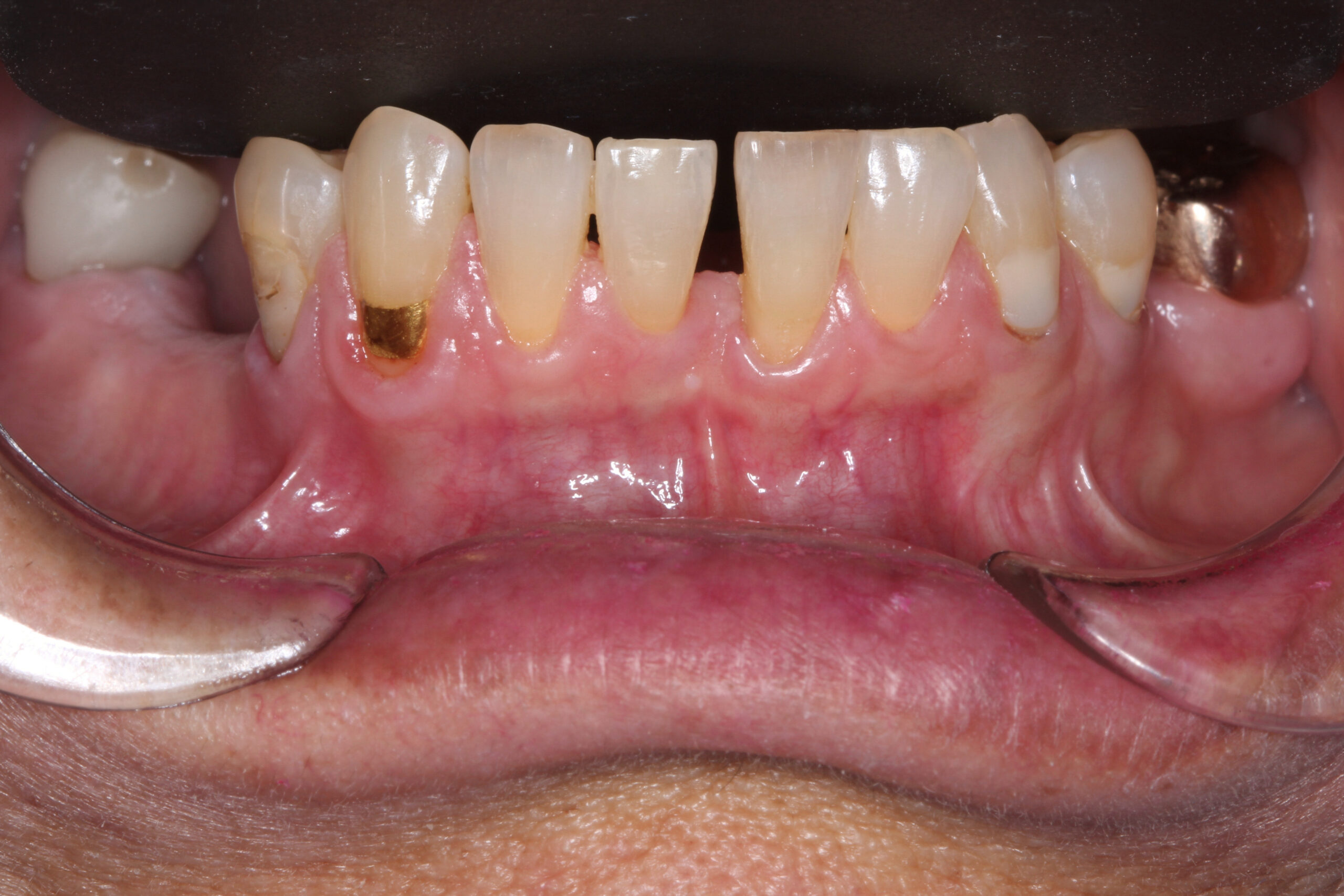 Before patient 10
